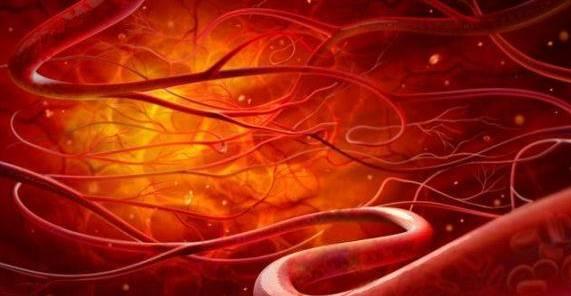 这些传说能软化血管的食物,统统是假的!