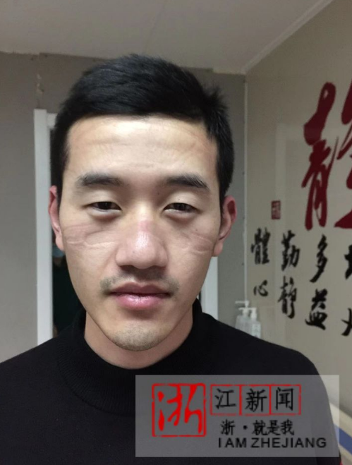 记住这些英雄！温州第二批援鄂医疗队回家