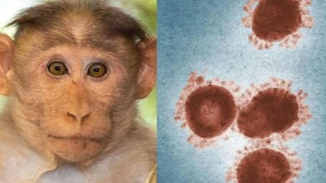 已发生人传人！“猴痘”是种什么病？天花疫苗是否有效？