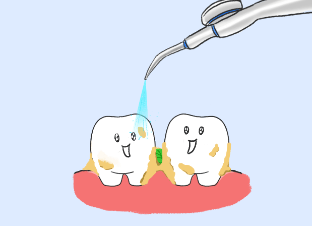 洗牙对牙齿有害吗？