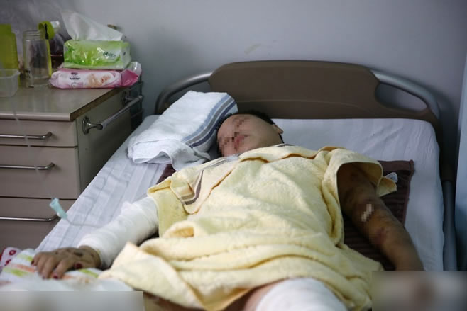 安徽女子救小孩被狗咬重伤 系编造骗捐款