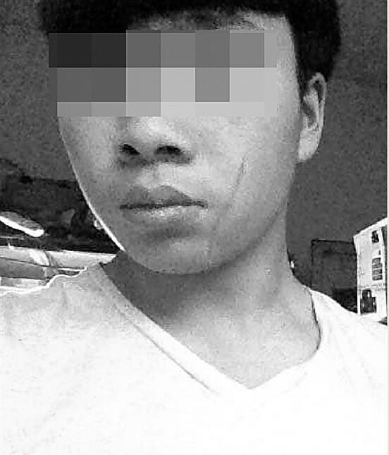 16岁少年为阻邻居家暴遭砍 脸上留下10厘米疤痕
