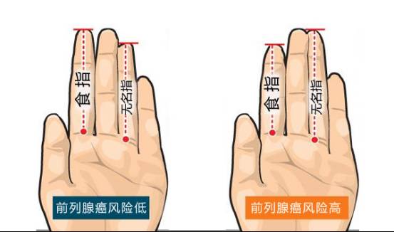 手指竟包含那么多秘密 测试告诉你答案