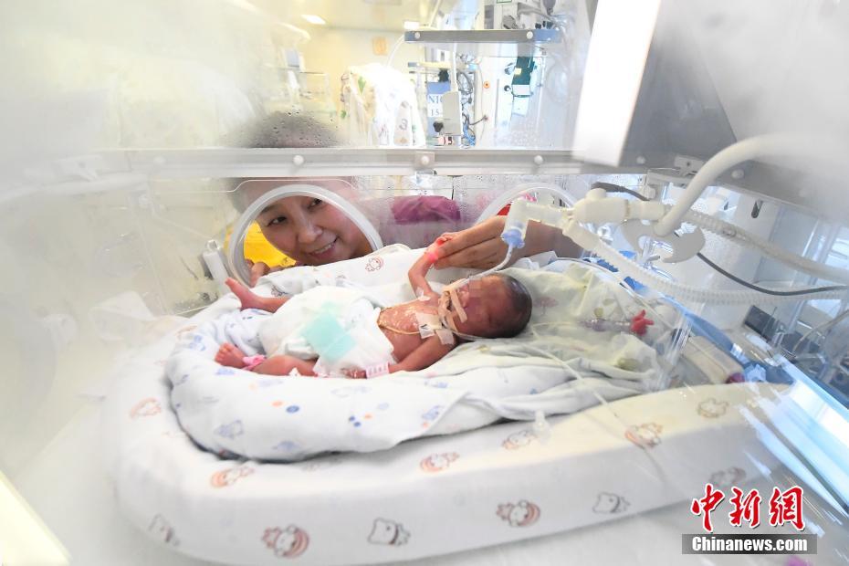 山西首例孕24周“手掌婴儿”救治成功