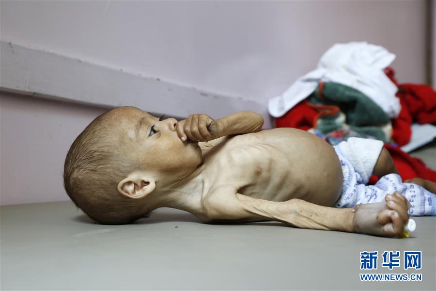 联合国警告也门面临大范围饥荒