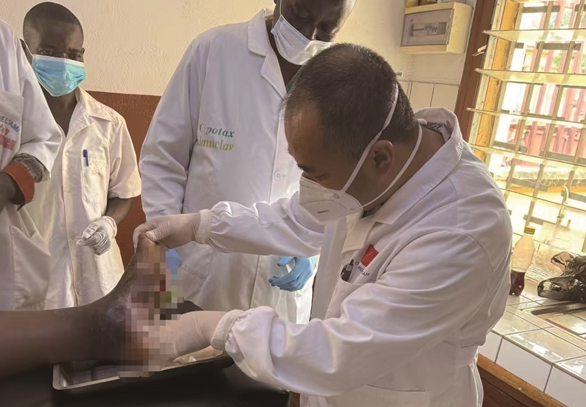 温州援非医生制作“简易神器” 守护中非“糖足”患者生命健康