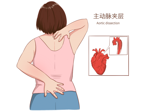 40岁男子把“血管炸弹”当肠胃炎险丧命