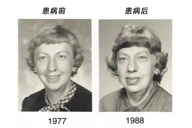 ��������NO.612ح���ӱ���ֽű�֣��𵱡���������ҽ���������������ǰ�ף�