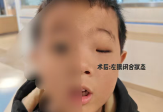 ��������NO.613ح5���޸�ð���۾��׳ɡ�С���ݡ� ���Ǳ���״���