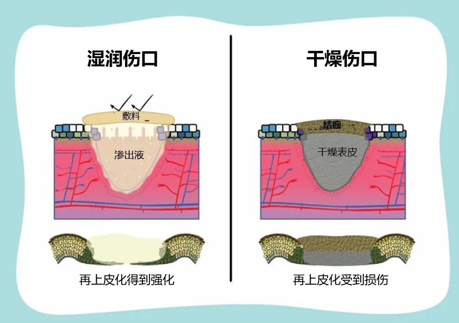 ��ҥѧ��NO.306ح�˿����ɺã����Ǳ�ʪ�ã��ܶ��˵�һ���ʹ���