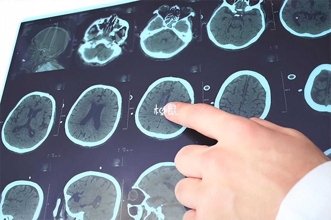 2026��������������ɸ�鿪ʼ�� �������޴�40�꽵��30��